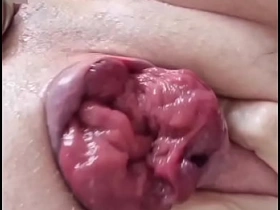 asshole